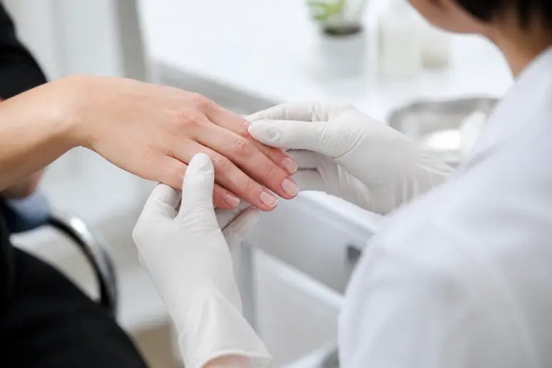 Main examinée pour un effet secondaire vernis semi-permanent, signes d'irritation.