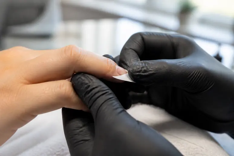 Mise en place d'un chablon pour reconstruire la forme d'un ongle rongé