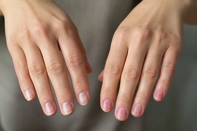 Main préparée pour pose vernis semi-permanent à domicile versus main en cours de dépose, le tarif vernis semi permanent à domicile varie selon le service.